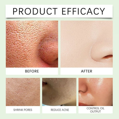 🔥Hot Sale🔥 GreTeam Purifying Exfoliating Gel