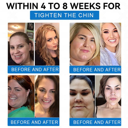 【Last Day Promotion 60% OFF🌟】🌈🌈ZVOEVO® SMGT-GLP-1 𝐓𝐢𝐫𝐳𝐞𝐩𝐚𝐭𝐢𝐝𝐞 & 𝐂𝐨𝐥𝐥𝐚𝐠𝐞𝐧 𝐍𝐚𝐧𝐨 𝐌𝐢𝐜𝐫𝐨𝐧𝐞𝐞𝐝𝐥𝐞 𝐖𝐞𝐢𝐠𝐡𝐭 𝐋𝐨𝐬𝐬 𝐏𝐚𝐭𝐜𝐡丨Targets Obesity, Loose Skin, High Blood Pressure, Diabetes, Fatty Liver, Joint Pain, Brain Fog, Low Energy, Body Aches, and More