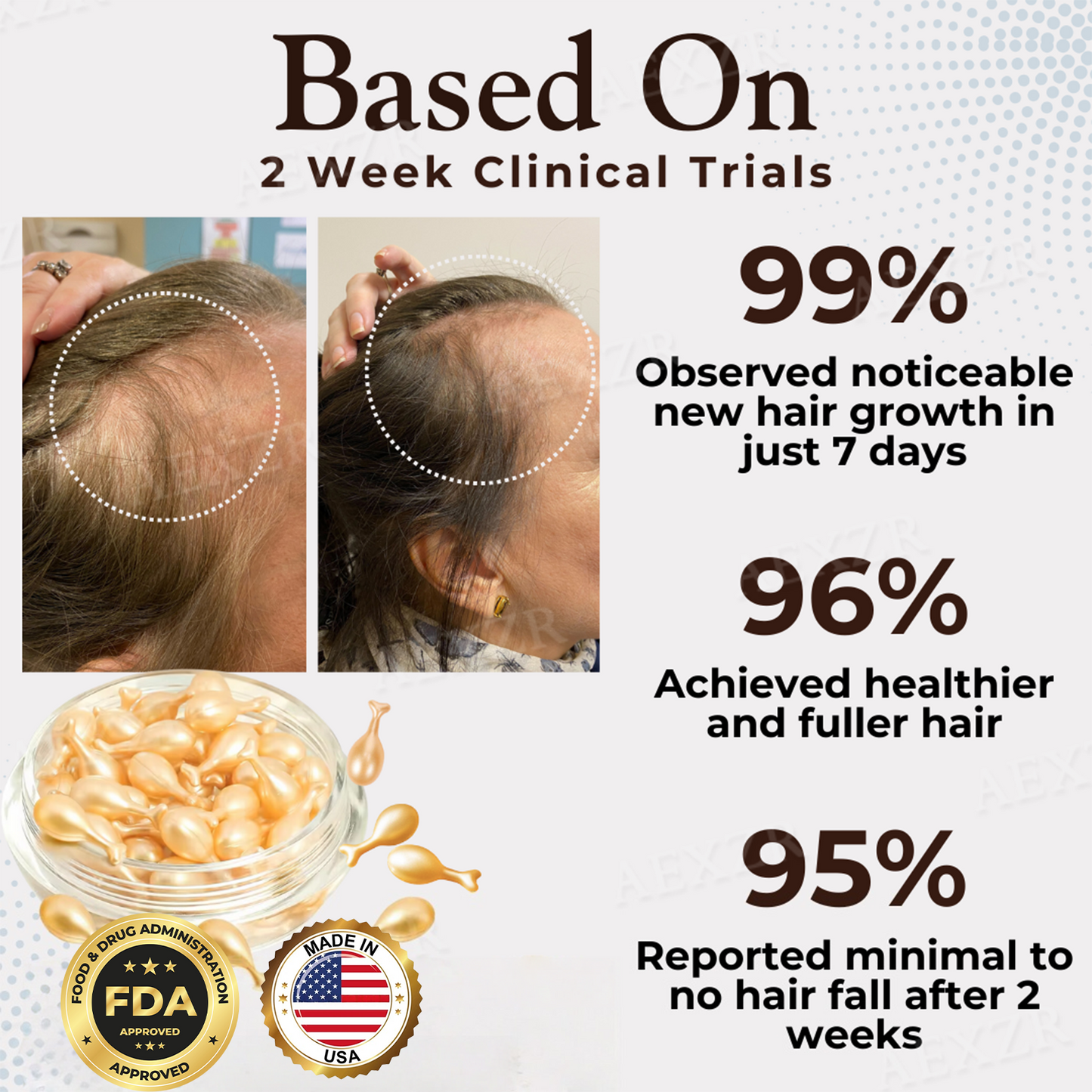 Hairgenz™ Hair Regrowth Capsules